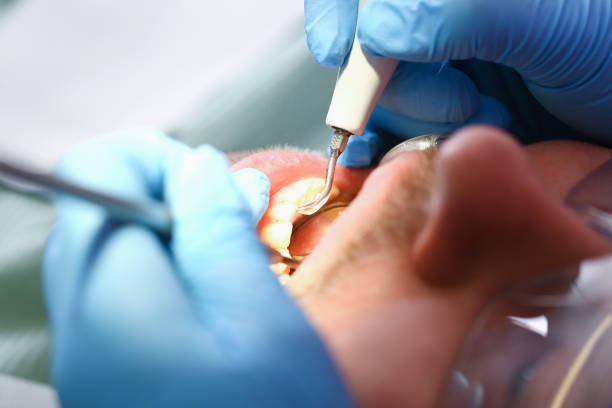 Best Dentist for Tooth Abscess  in Glenview, IL